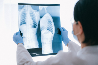 תמונה עבור On World Lung Day, pulmonologists pray for Gaza hostages